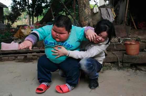 小六男童患脂肪肝!媽不解喊「都吃清蒸水煮」戒掉炸物 醫生「看完菜單後傻眼」:吃錯了啦