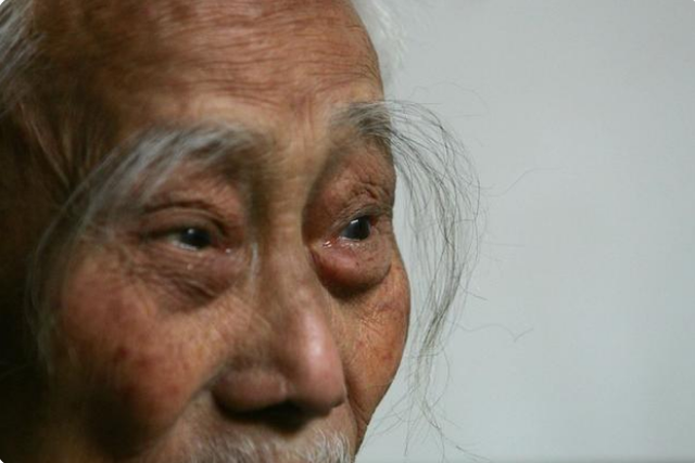 中老年男人「眉毛變長」意味著什麼?醫生提醒:眉毛變化或是疾病信號 「3大原因」要心中有數