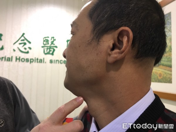 吃飯別配這種魚!醫師警告「鼻咽癌高7倍」每年千人罹癌 3關鍵因素「幼兒也不要碰」:越早吃越早罹癌