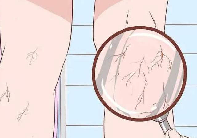 「肺部有癌」雙腳先知！若同時出現4個現象「已到了中晚期」 　不要忽略早期信號