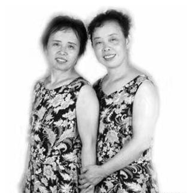 一模一樣！她們做閨蜜34年後「突然做DNA」竟是雙胞姐妹　揭開多年真相：狠心父決定「讓親母早逝」