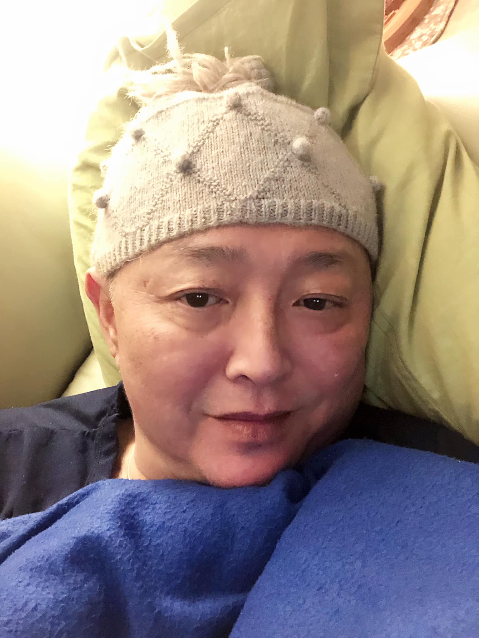 突爆不能走路！李國超「認小水泡變大手術」已超過半年　醫勸「植皮恐也沒用」拄拐杖現身了