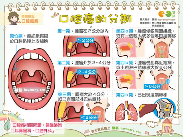 無不良嗜好卻得口腔癌！20歲女確診崩潰「特愛吃2美食釀大禍」　醫警告「出現5大口腔異狀」快就醫