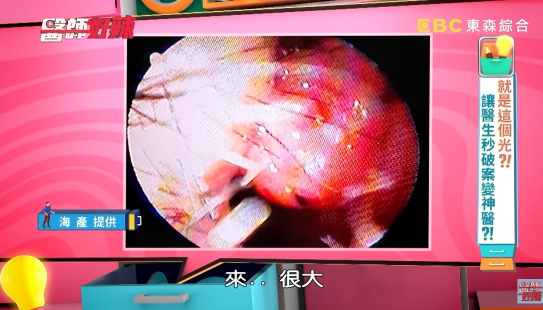 長期聞到異味！34歲男星曝「阿嬤以為他卡到陰」喝香灰水化解　拖半年就醫「一查已經擴散了」