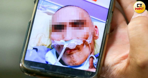桃園恐怖安養院！爸爸入住半年「下半身都是洞」瘦成骨頭人　家屬自責「親手推入火坑」安養院反嗆：關我們什麼事