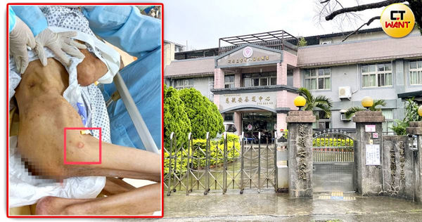 桃園恐怖安養院！爸爸入住半年「下半身都是洞」瘦成骨頭人　家屬自責「親手推入火坑」安養院反嗆：關我們什麼事