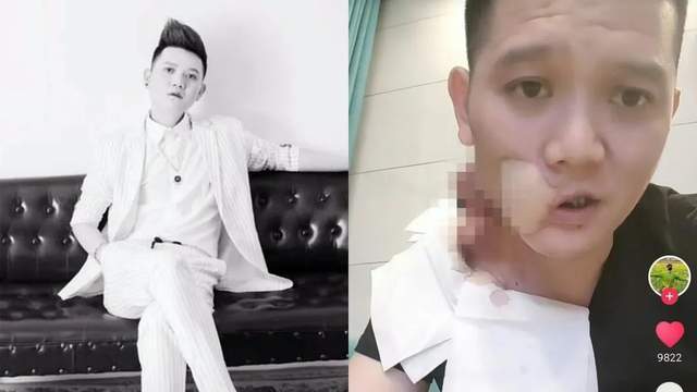 36歲歌手患癌離世！三度復發搶救不治「病因曝光」　生前勸誡網友遠離「這款零食」：正在毀掉很多人