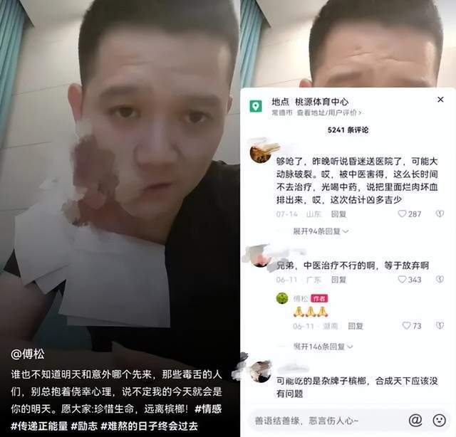 36歲歌手患癌離世！三度復發搶救不治「病因曝光」　生前勸誡網友遠離「這款零食」：正在毀掉很多人