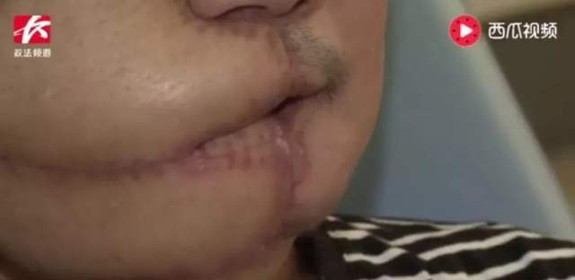 36歲歌手患癌離世！三度復發搶救不治「病因曝光」　生前勸誡網友遠離「這款零食」：正在毀掉很多人