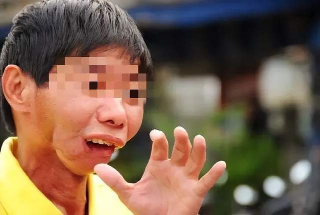 36歲歌手患癌離世！三度復發搶救不治「病因曝光」　生前勸誡網友遠離「這款零食」：正在毀掉很多人