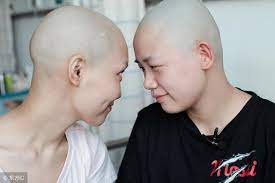 為了給媽媽鼓勵!孝女「為癌母剃光頭」剪掉留6年長髮 男友一看「不接受提分手」網風向一面倒