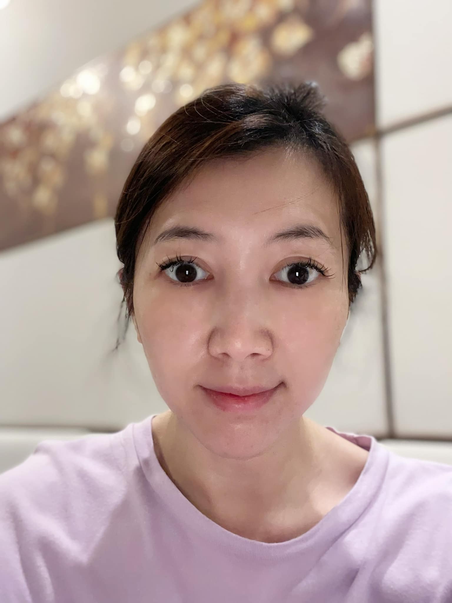 家庭爆發衝突！49歲八點檔女星驚吐「遭媽媽拿菜刀砍傷」獨自就醫　「忍痛縫完21針」肌腱差點不保