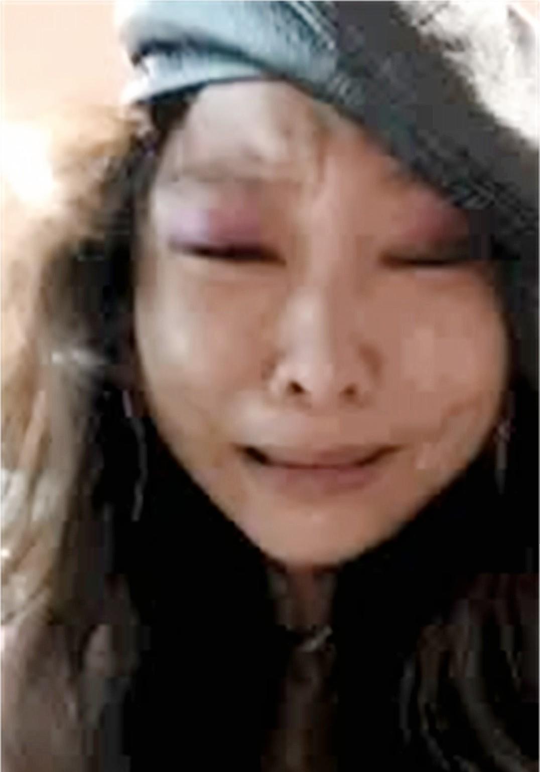 51歲天后變瘋女「被送進精神病院」！為愛癡狂淪落街頭　被家人奪走財產：將一手好牌打爛