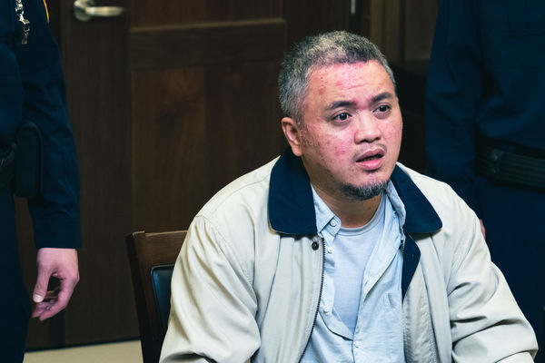 為戲賣命！實力派男星「故意停藥引發病」全身冒大片紅疹　工作人員讚特效好「他痛苦回是真的」