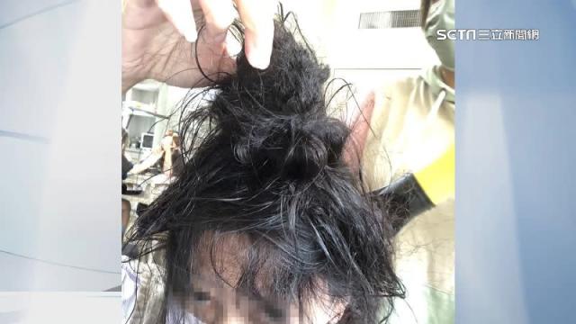 頭髮一直掉！5個「超母湯的洗髮習慣」看你中幾個　醫生搖頭「嚴重恐致病」：還會發出異味