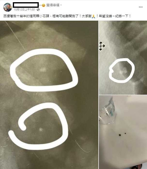 10年治不好!卜學亮「緊急入院」曝光病因 他透露「可能離開了」粉絲急關心