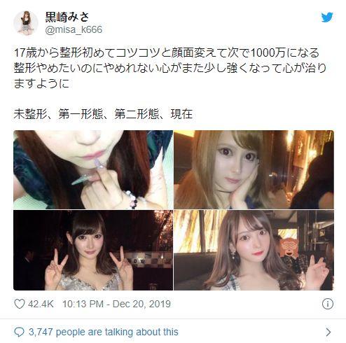迷戀整形！17歲妹「8年砸1000萬」家人勸不聽　最後「決定整回原廠設定」網友看傻了