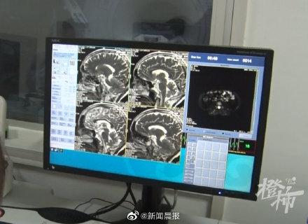 帶孫子去吃麵！陌生鄰桌「猛盯婦人一直看」急勸：快去醫院　一檢查「結果讓她嚇壞」3徵兆沒注意