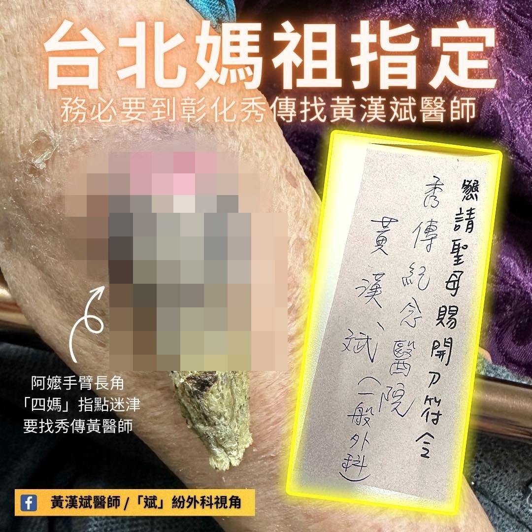 手臂長巨角！91歲嬤「南下尋仁醫」激動喊：媽祖叫我來　「拿出仙界轉診單」網讚：神明唯一指定