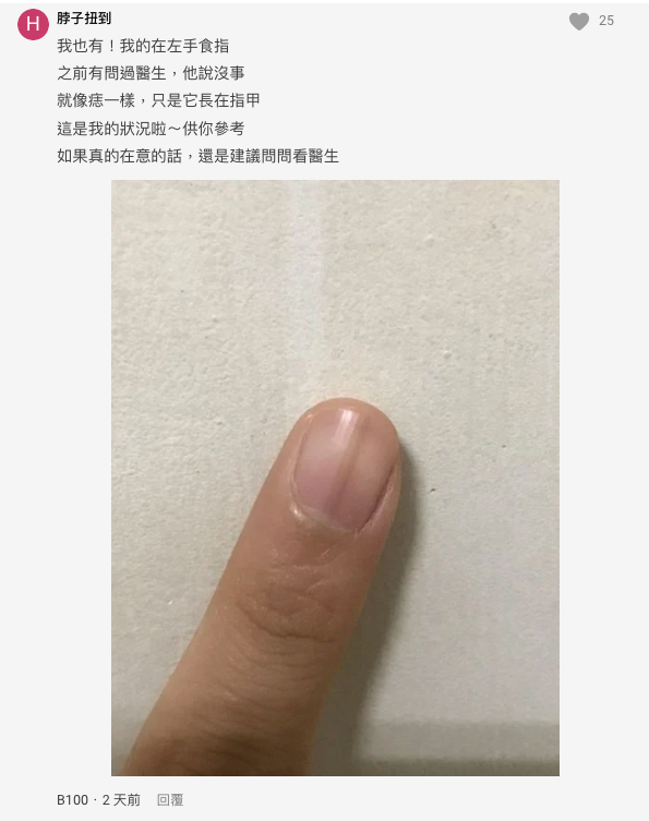 大拇指上出現「神秘筆直黑線」！　男大生好奇問「這個是什麼？」過來人嚇喊：趕快去醫院