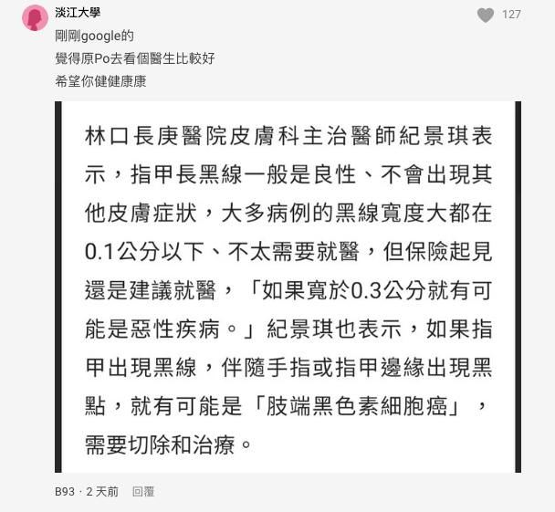 大拇指上出現「神秘筆直黑線」！　男大生好奇問「這個是什麼？」過來人嚇喊：趕快去醫院