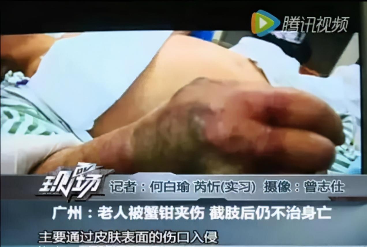 男子處理豬肉差點沒命！只因「一個致命疏忽」　做菜的人都會犯：太常見了