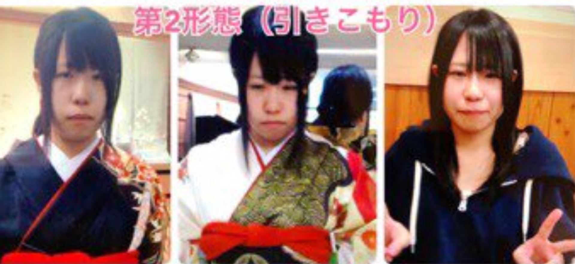 夢想當模特兒！小眼女被笑「沒有照過鏡子」　她決定整形「25歲逆襲為美女CEO」正到撞臉女明星