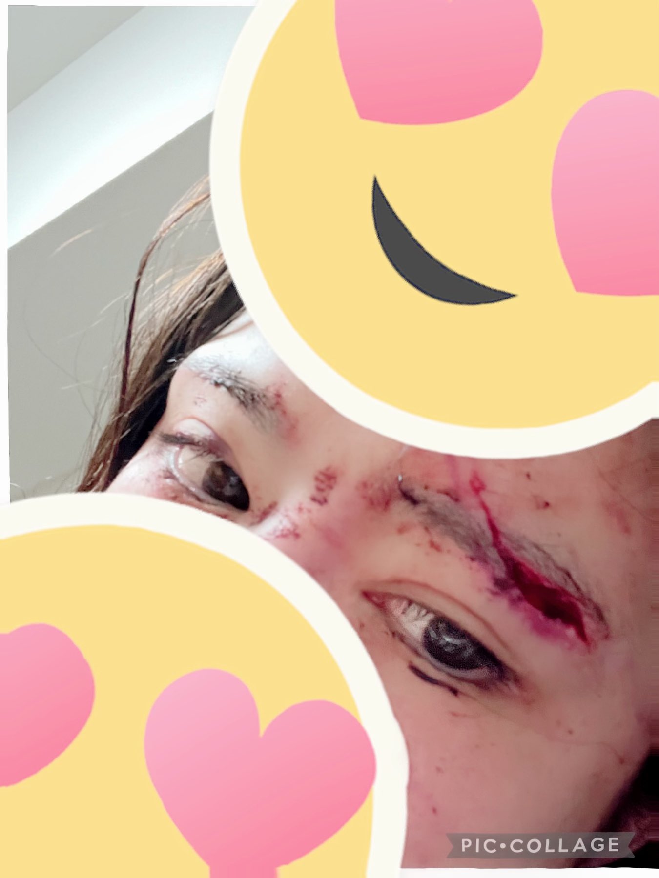 才正準備走紅！知名女星「車禍被撞臉著地」嚴重破相　傷勢曝光「演藝生涯恐全毀」經紀人出面回應了