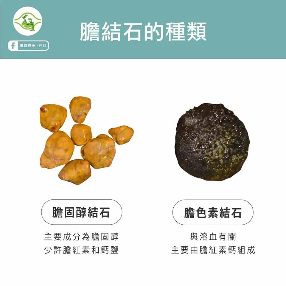 星雲燒出五彩舍利子！網愣「難道是結石」顆顆光滑如珍珠　醫曝「生前健康狀況」：明明差很多