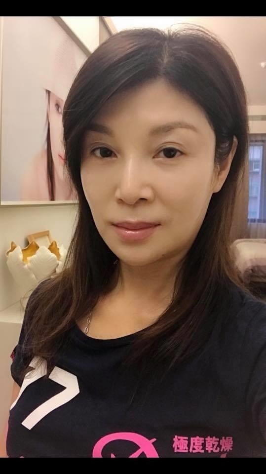 怪病纏身多年！57歲台語歌后「突然鬆口想引退」　飽受折磨「搥牆想要尋死」：醫生也無解