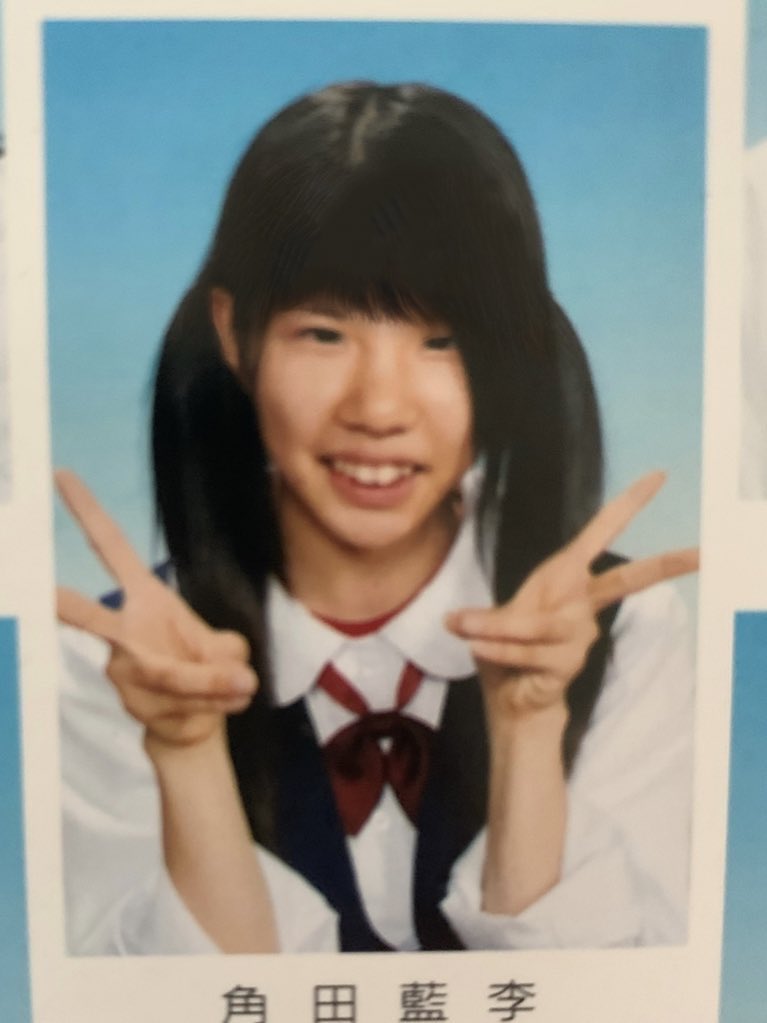 換臉得新生！暴牙妹被嫌「長這樣別生小孩」超自卑　撒230萬整形「逆襲成大眼甜美正妹」狂圈81萬粉