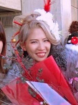 換臉得新生！暴牙妹被嫌「長這樣別生小孩」超自卑　撒230萬整形「逆襲成大眼甜美正妹」狂圈81萬粉