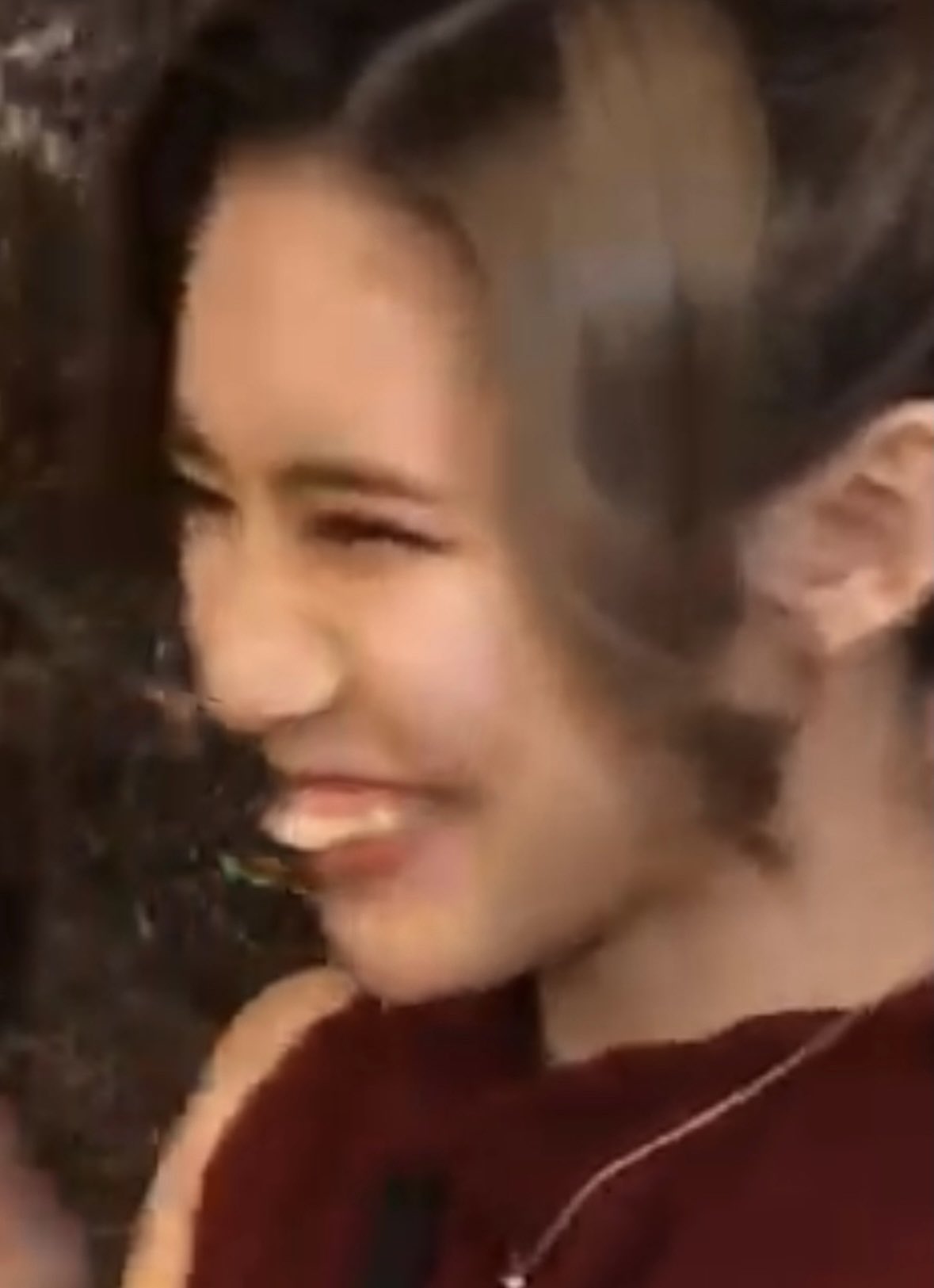 換臉得新生！暴牙妹被嫌「長這樣別生小孩」超自卑　撒230萬整形「逆襲成大眼甜美正妹」狂圈81萬粉