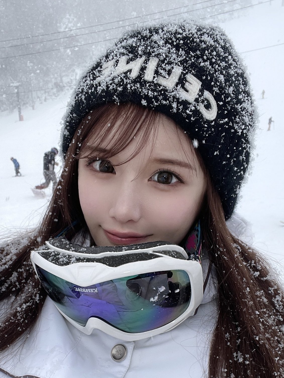 換臉得新生！暴牙妹被嫌「長這樣別生小孩」超自卑　撒230萬整形「逆襲成大眼甜美正妹」狂圈81萬粉