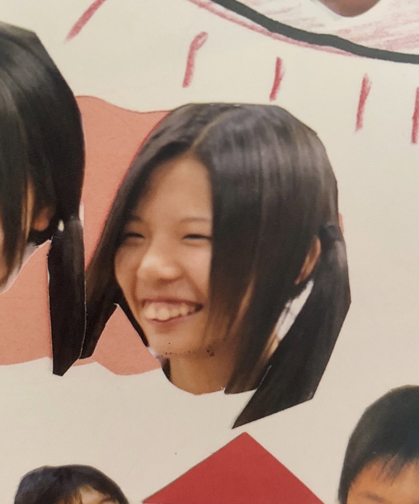 換臉得新生！暴牙妹被嫌「長這樣別生小孩」超自卑　撒230萬整形「逆襲成大眼甜美正妹」狂圈81萬粉