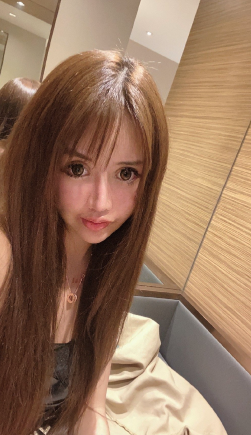 13歲迷上整形！她花千萬整上百次「變白皙大眼蛇精妹」　曬出「最原始樣貌」呼籲：真的別學我