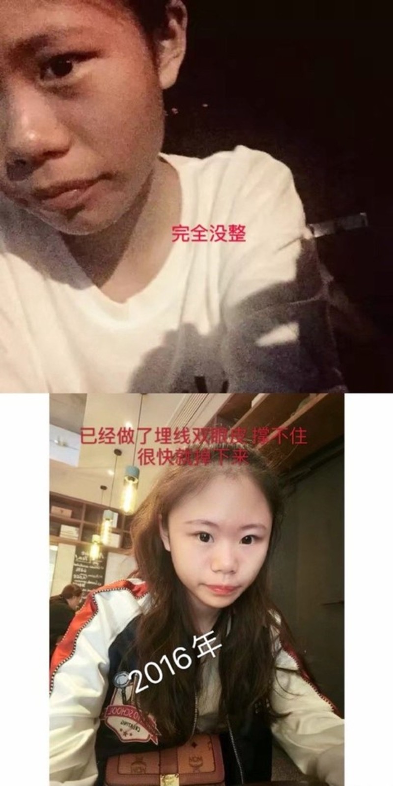 13歲迷上整形！她花千萬整上百次「變白皙大眼蛇精妹」　曬出「最原始樣貌」呼籲：真的別學我