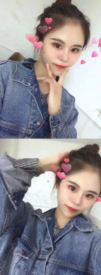 13歲迷上整形！她花千萬整上百次「變白皙大眼蛇精妹」　曬出「最原始樣貌」呼籲：真的別學我
