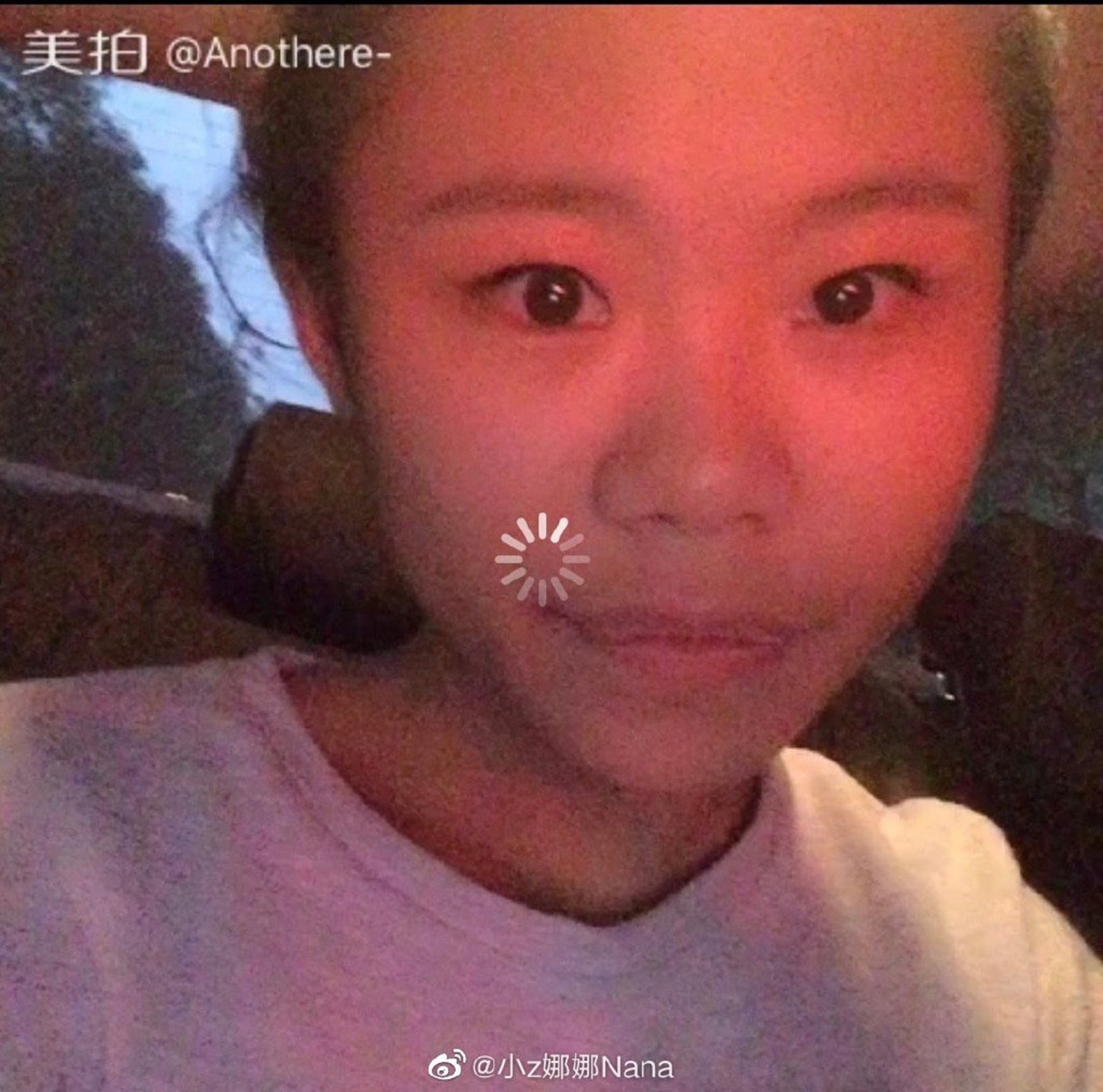 13歲迷上整形！她花千萬整上百次「變白皙大眼蛇精妹」　曬出「最原始樣貌」呼籲：真的別學我