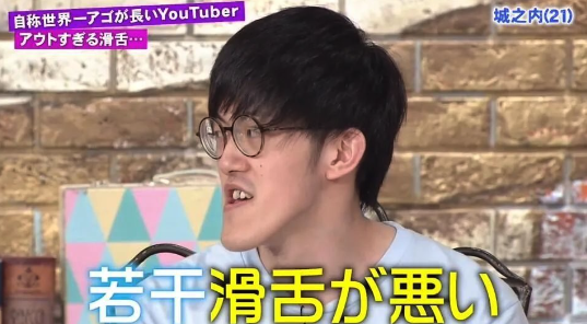 他擁有「世界最長下巴」爆紅全網！一照X光「揭開骨骼真相」醫生也傻眼：太特殊了...