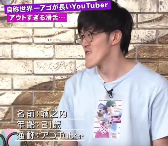 他擁有「世界最長下巴」爆紅全網！一照X光「揭開骨骼真相」醫生也傻眼：太特殊了...