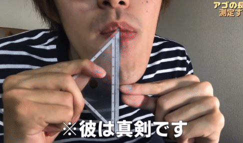 他擁有「世界最長下巴」爆紅全網！一照X光「揭開骨骼真相」醫生也傻眼：太特殊了...