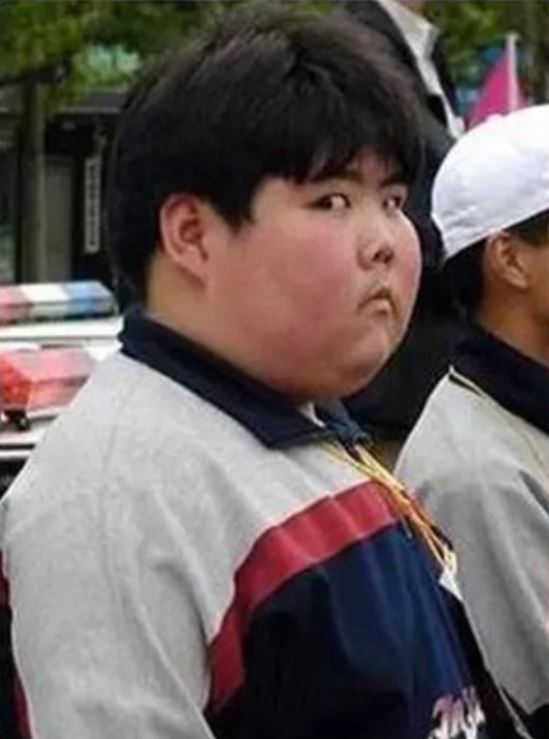 體重破百公斤！26歲男「糖尿病+脂肪肝」頻尿又口渴　醫師點名「只要戒掉這一物」70天後幾乎痊癒