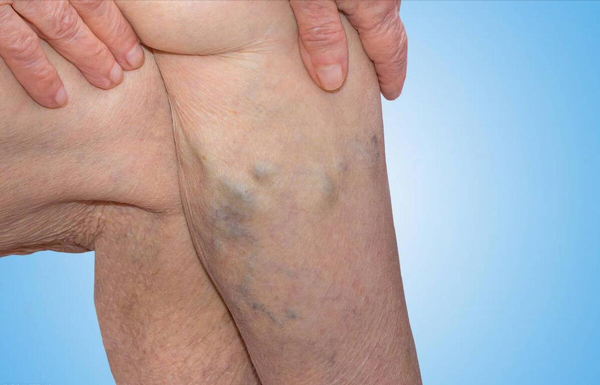 女性開始衰老時！下半身一般會有「3個徵兆」　若沒有「說明你還年輕」