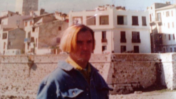 她砸230萬「整成厚嘴唇大媽」嚇壞全球！公開以前模樣「原本是挺鼻美男子」家人氣到不往來