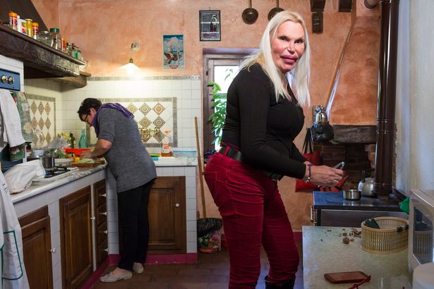 她砸230萬「整成厚嘴唇大媽」嚇壞全球！公開以前模樣「原本是挺鼻美男子」家人氣到不往來