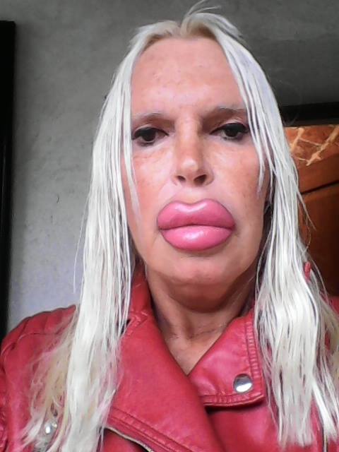 她砸230萬「整成厚嘴唇大媽」嚇壞全球！公開以前模樣「原本是挺鼻美男子」家人氣到不往來