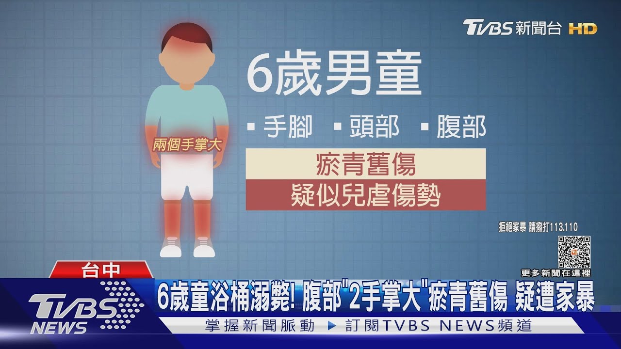 父子一起泡澡！他出去講電話回來「驚見6歲兒斷氣」崩潰求救　醫曝「身上多處瘀青」查記錄看傻了