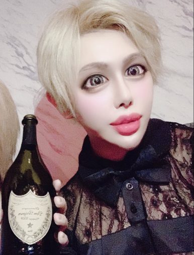 被富婆包養!他不工作「狂燒2900萬整形」還能拿零用錢 每天陪金主吃飯「整前臉蛋曝光」網嚇呆