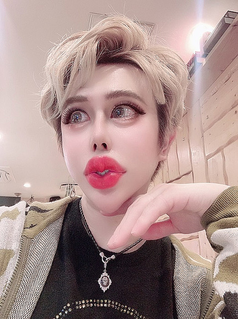 被富婆包養!他不工作「狂燒2900萬整形」還能拿零用錢 每天陪金主吃飯「整前臉蛋曝光」網嚇呆